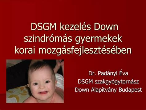 A Down-szindrómás gyermekek fejlesztési programja