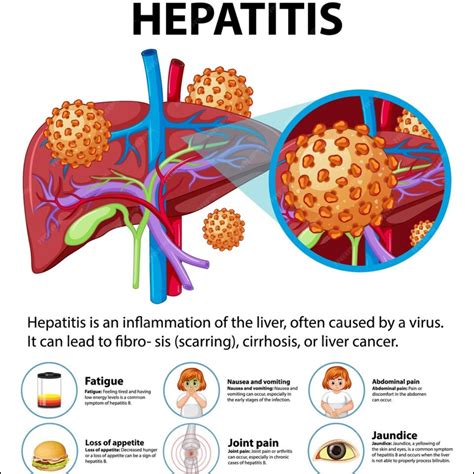 A Hepatitis B átviteli módjai