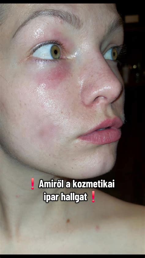 Káros kozmetikai összetevők listája és azok hatása