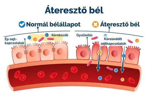 Anyatej és bélflóra