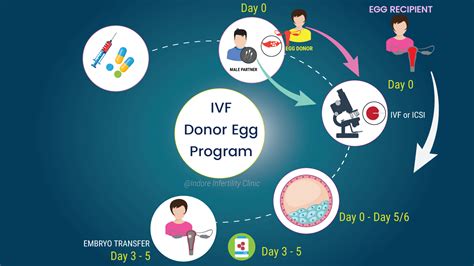 A donor petesejt IVF előkészületeit bemutató ábra
