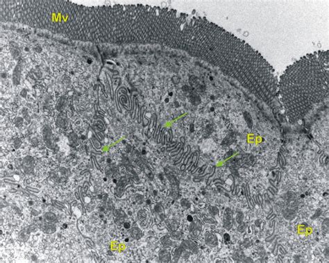 Elektronmikroszkópos felvétel calicivírusokról