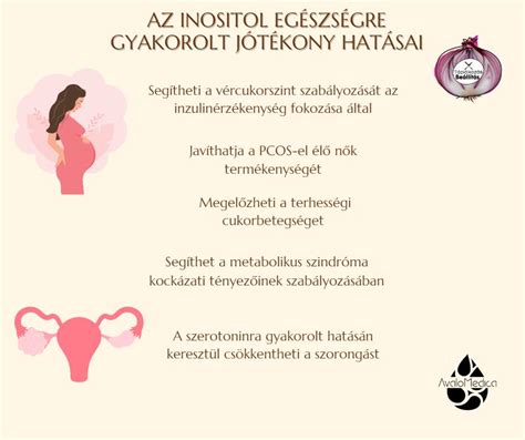 A petefészek-túlstimulációs szindróma