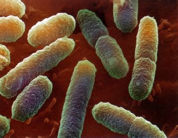 Az E. coli baktérium és a húgyúti fertőzések kapcsolata