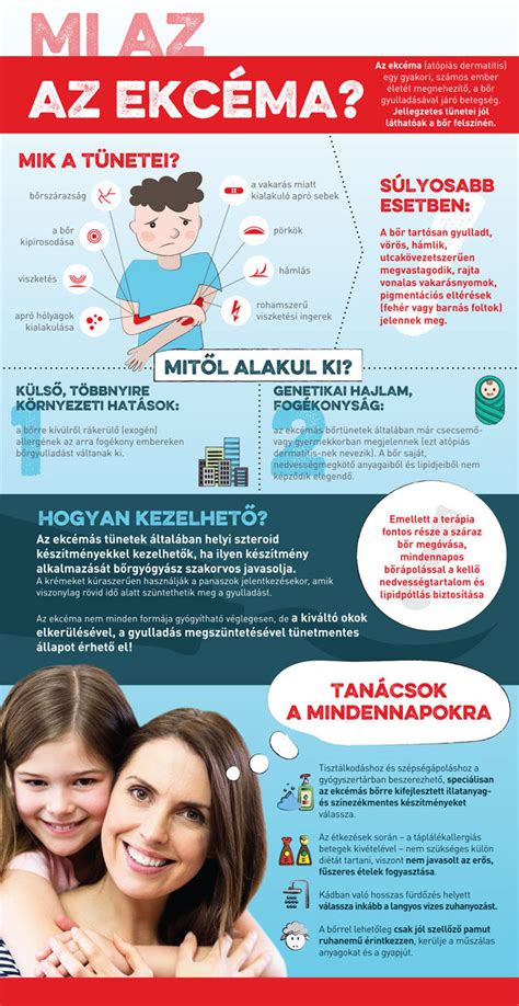 Az ekcéma okait bemutató infografika