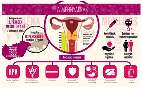 A koraszülés kockázati tényezői és megelőzési lehetőségei infografika