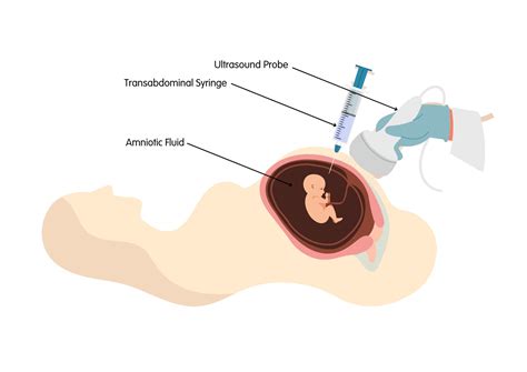 Amniocentesis és CVS bemutatása
