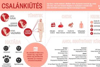 A csalánkiütés lehetséges okai