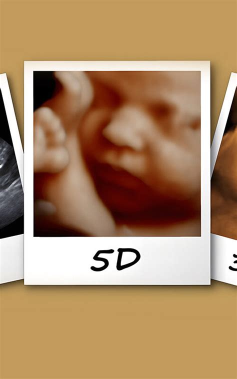 5D babamozi ultrahang kép a magzatról