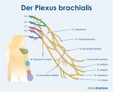 Plexus Brachialis bénulás