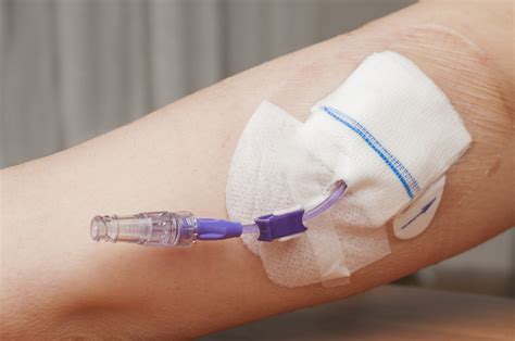 PICC katéter újszülött karjában