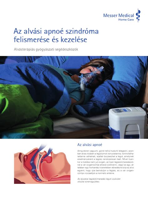 Ábra az alvási apnoé mechanizmusáról