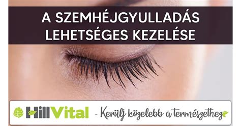 szemhéjgyulladás kezelése otthon