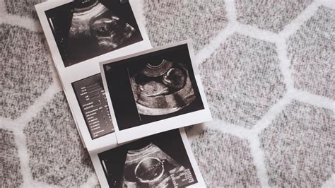 Magzati ultrahang vizsgálatok időbeli ütemezése