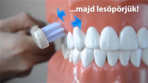 Helyes fogmosási technika gyermekeknek