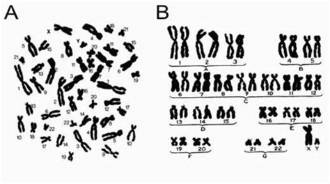 A nemi kromoszómák és a nemi meghatározás