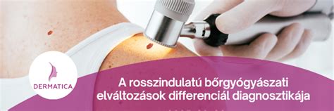 A bőrgyógyászati vizsgálatokat igénylő bőrtünetek és elváltozások listája