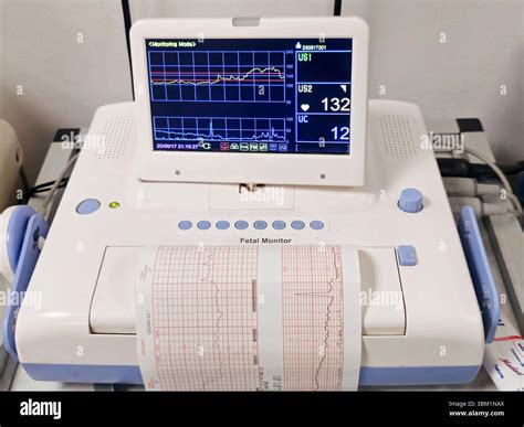 Kardiotokográf (CTG) monitor
