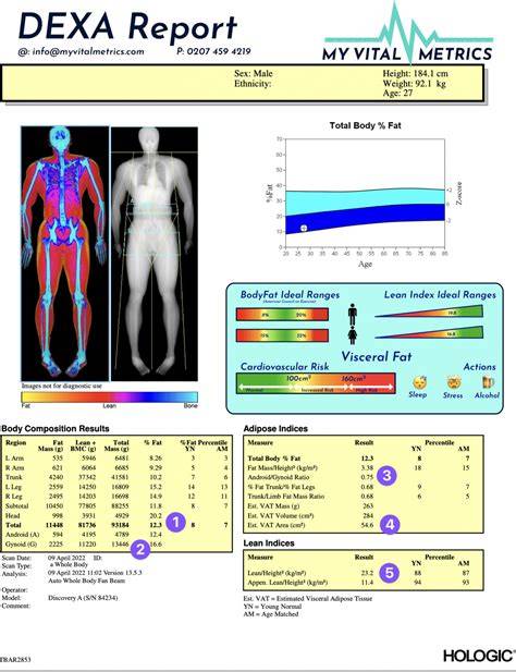 DEXA csontsűrűségmérés diagram