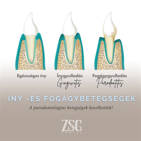 A macska anatómiai rajza az íny és a nyelv színének jelentőségével