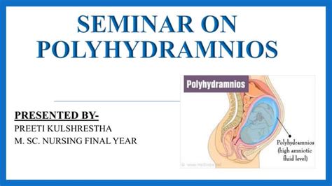 Ultrahangfelvétel polyhydramnion esetén