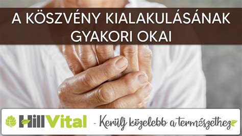 A köszvény kialakulásának fázisai infografika