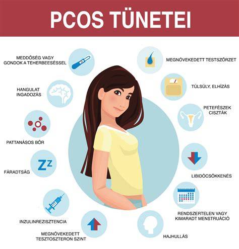 A PCOS tünetei és okai