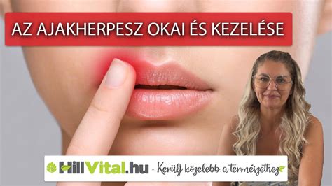 Ajakherpesz terjedési módjai és megelőzése infografika