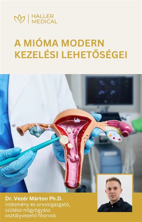 A mióma kezelési lehetőségei