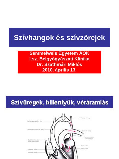 Szívzörejek elhelyezkedése