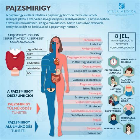 Pajzsmirigy alulműködés tünetei és hatása a női egészségre
