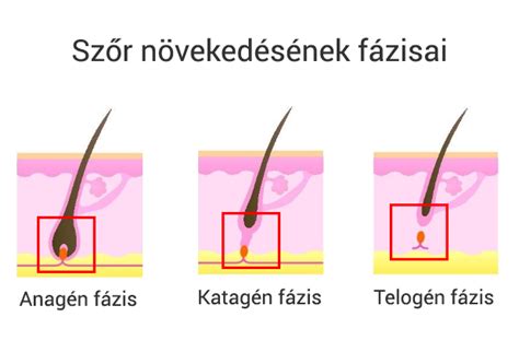 A méhszáj manuális tágításának fázisai