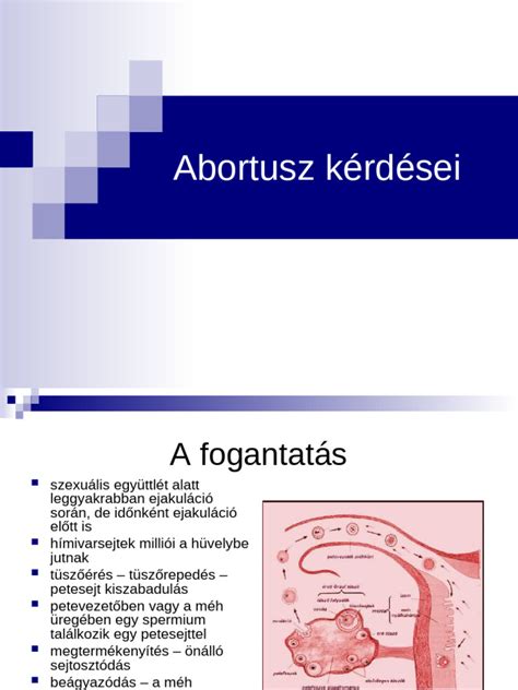 Abortusz eljárások illusztrációja