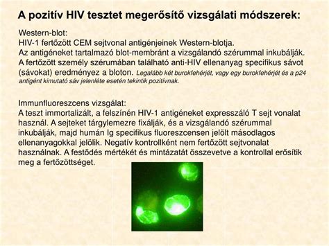 A HIV diagnosztikai módszerei