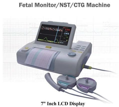 CTG monitorozás