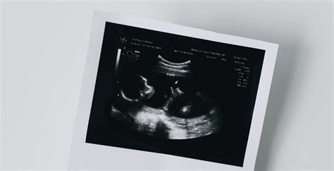 A petesejt donációval született gyermekek származási kérdései