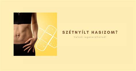 Szétnyílt hasizom illusztráció