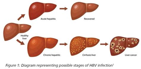 A Hepatitis B terjedési módjai
