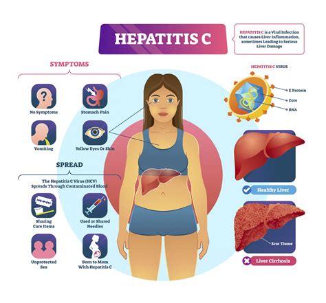 A hepatitis B és C vírus terjedése