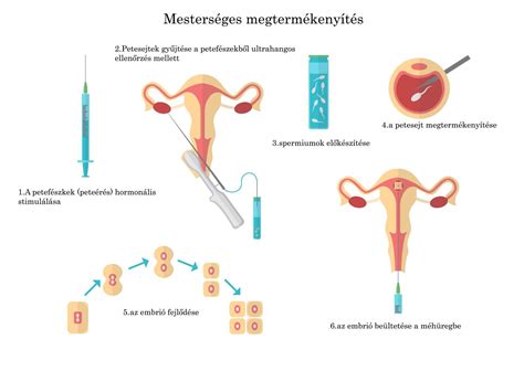A mesterséges megtermékenyítés sikerrátáit befolyásoló tényezők