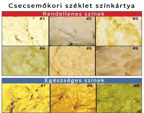 Baba székletének színei és állaga