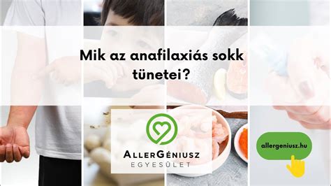 Anafilaxiás reakció tüneteit bemutató infografika