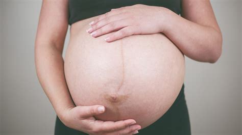 A linea nigra és a terhesség alatt sötétebbé váló területek