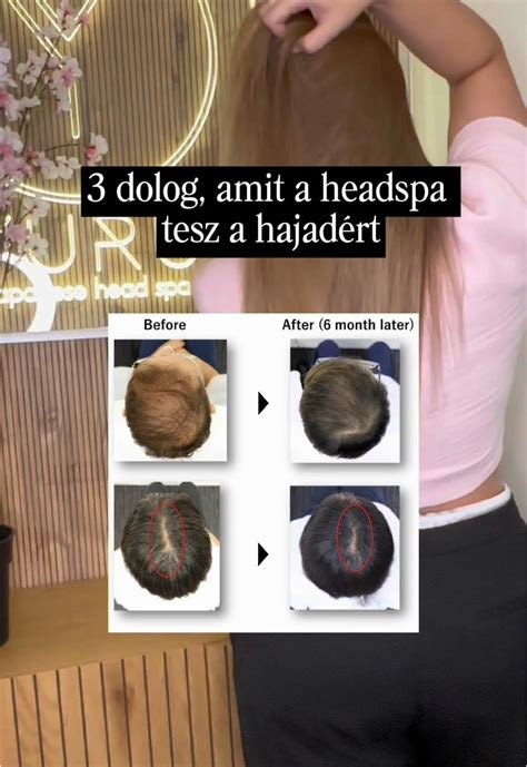 DNS és haj növekedés