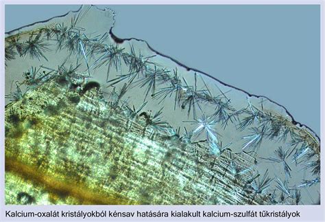 A kalcium-oxalát kristályok képződésének tényezői