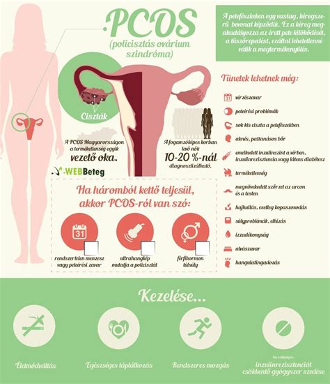 Infografika a Couvade szindróma tüneteiről és gyakoriságáról