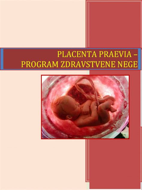 Kórházi tartózkodás placenta praevia esetén