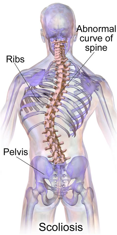 Gerincferdülés (scoliosis) vizsgálata