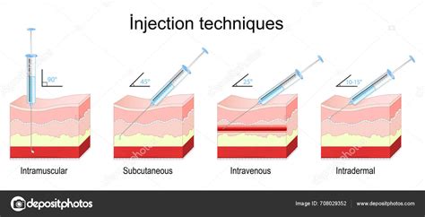 Szubkután és szublingvális immunterápia bemutatása