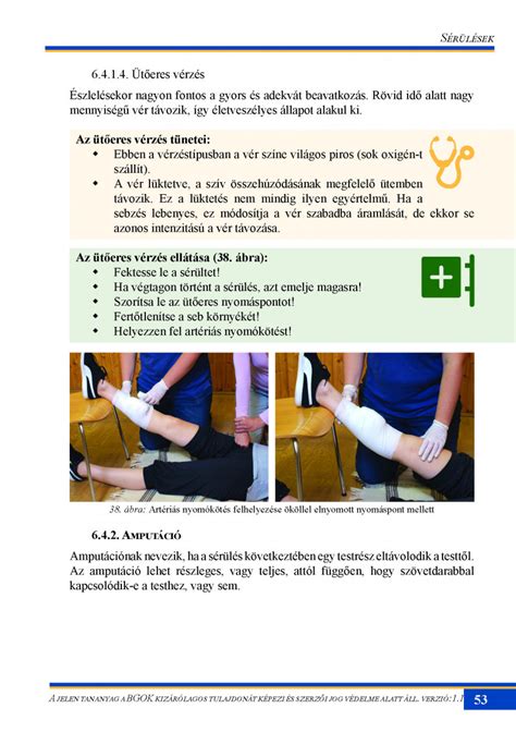 X-kötés lépései